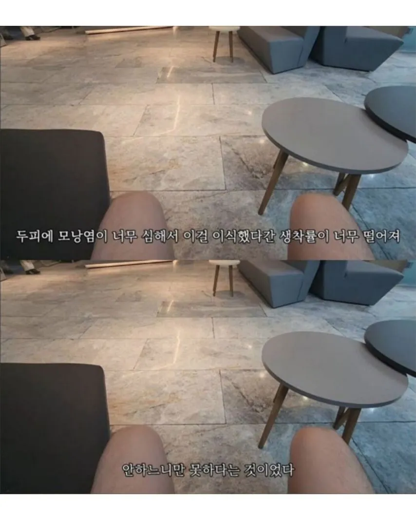 터키로 모발이식 받으러간 남성