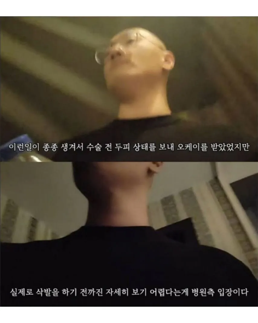 터키로 모발이식 받으러간 남성