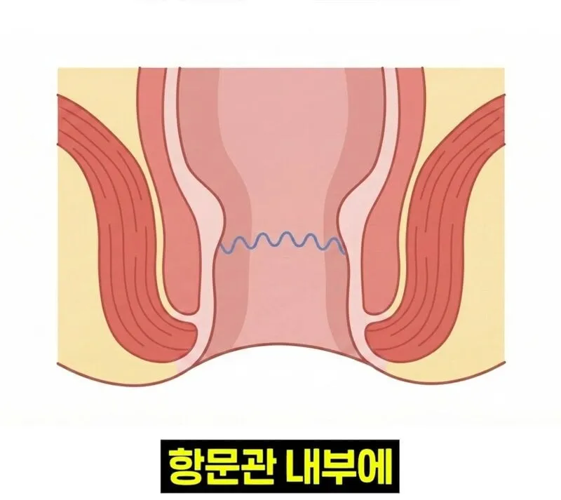우리 뇌가 방귀와 똥을 구분하는 방법