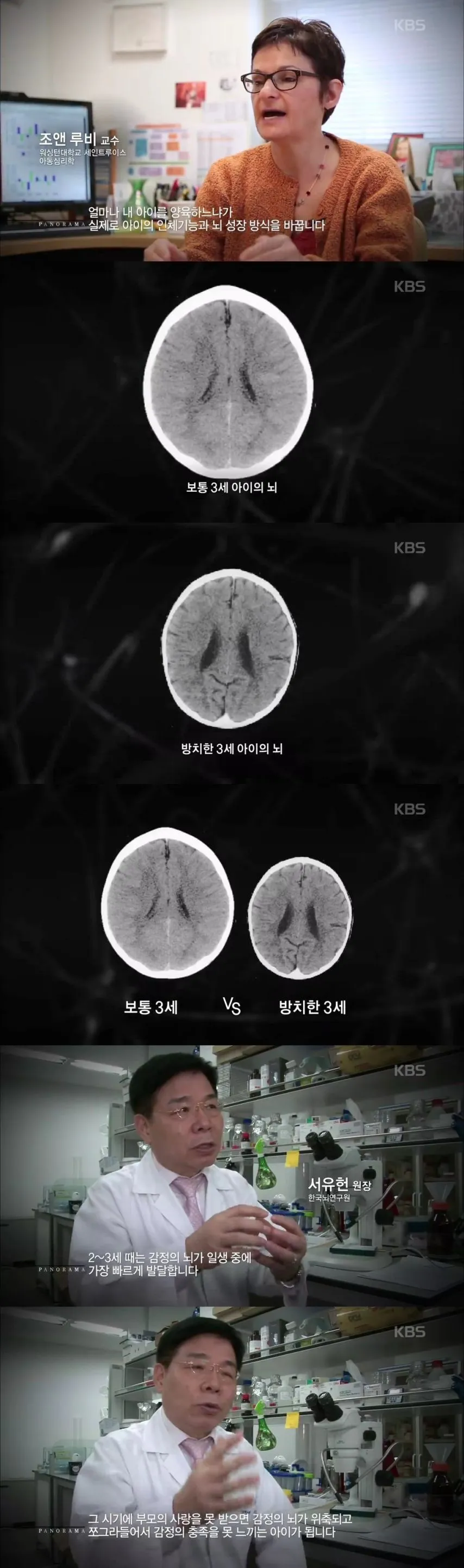 2-3살 아이가 사랑을 받지 못하면 생기는 일.