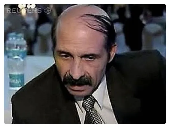 대머리를 가리는법!