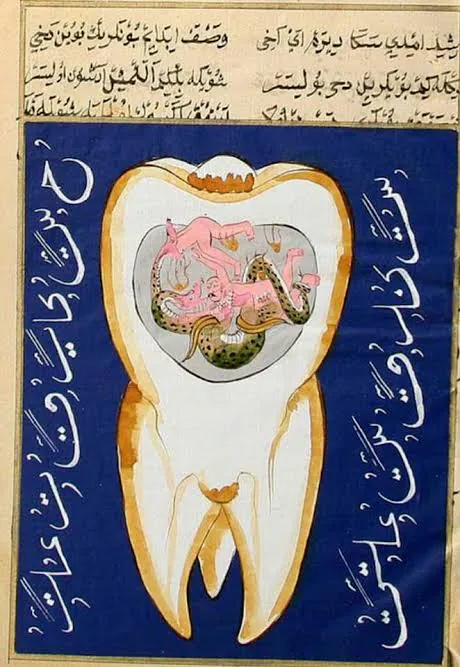 충치를 표현한 오스만 제국 시절 그림