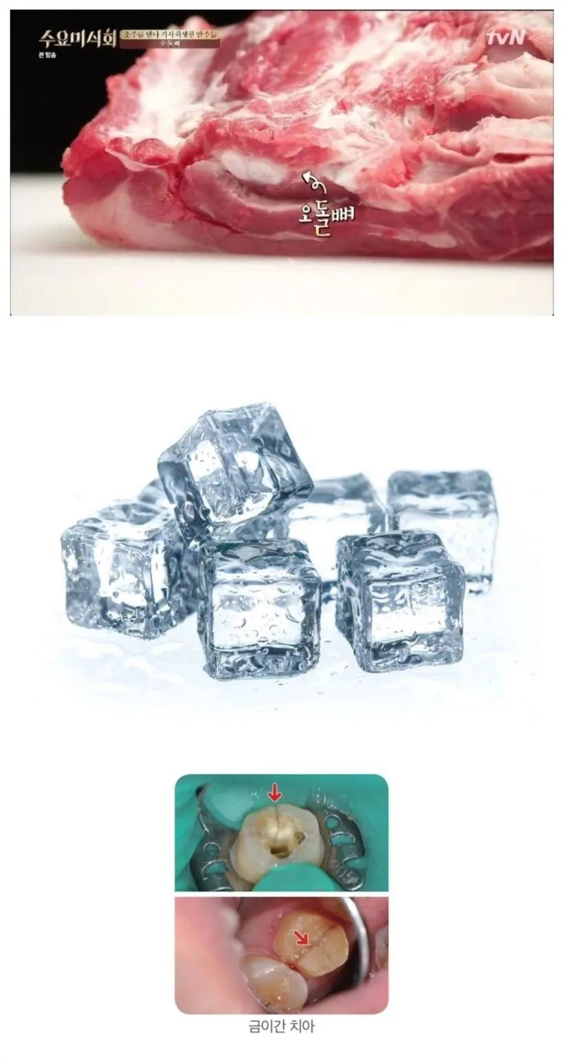 치과의사들이 진짜로 먹지말라는거