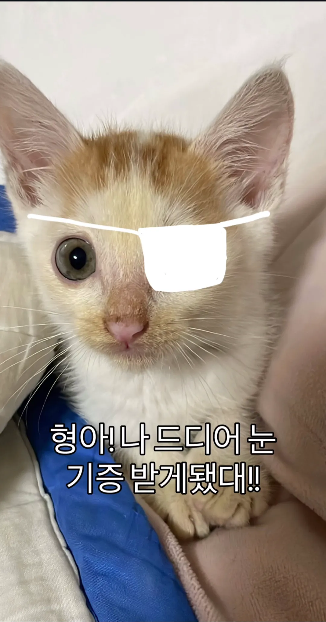 형아! 나 드디어 눈 기증 받게 됐대!