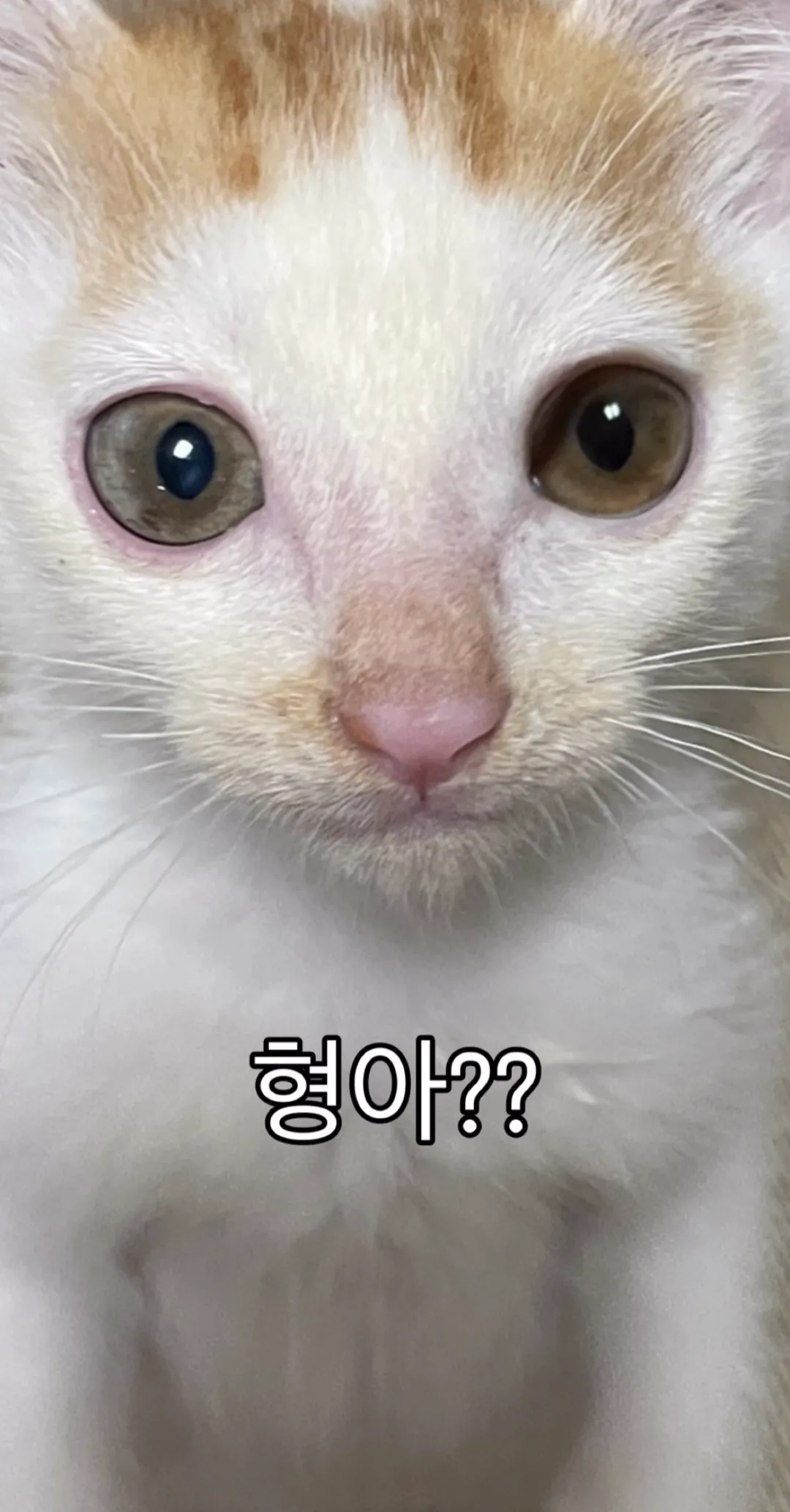 형아! 나 드디어 눈 기증 받게 됐대!