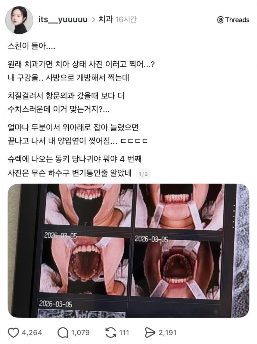 원래 치과가면 치아 상태 사진 이러고 찍어...?