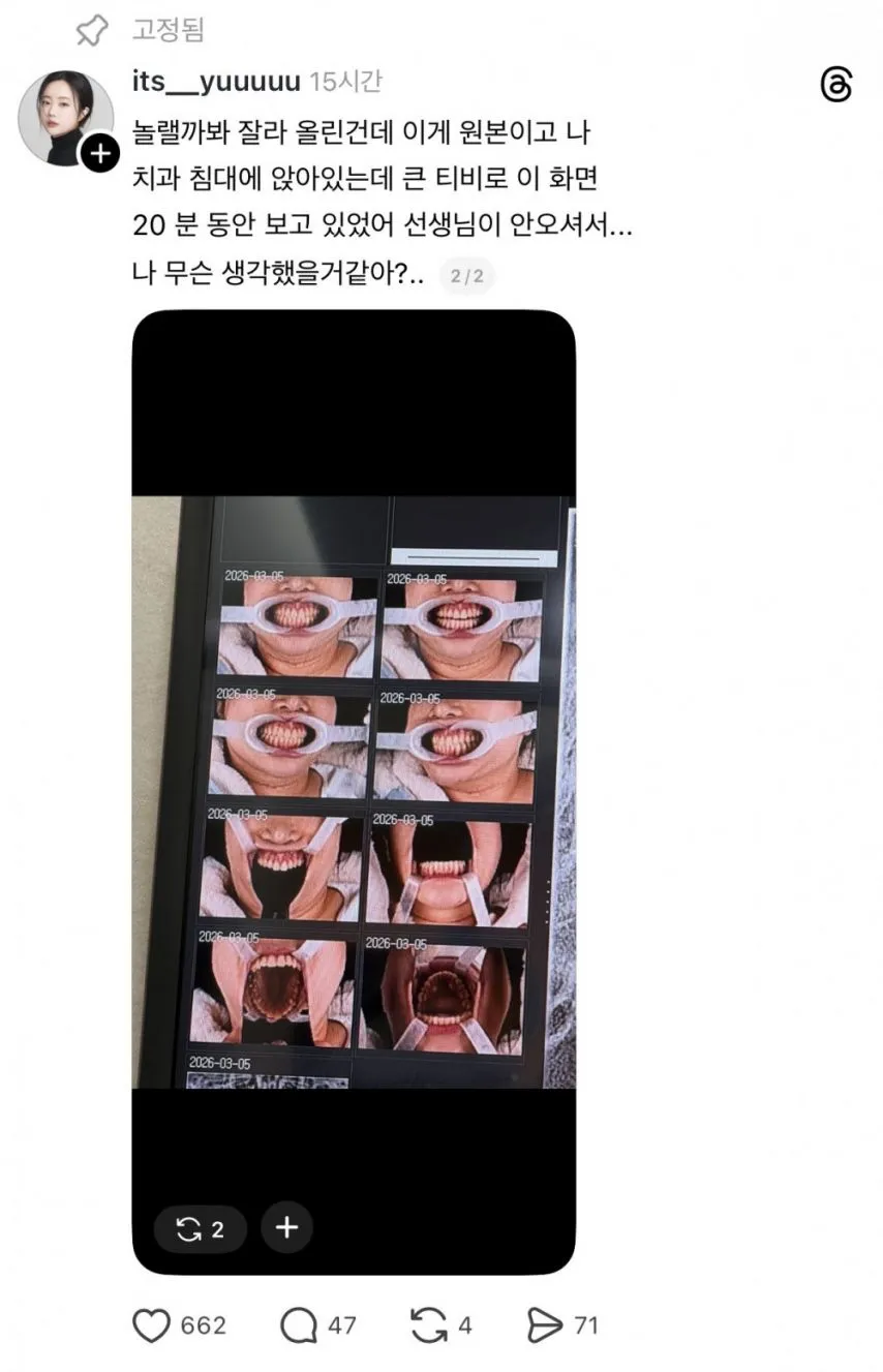 원래 치과가면 치아 상태 사진 이러고 찍어...?