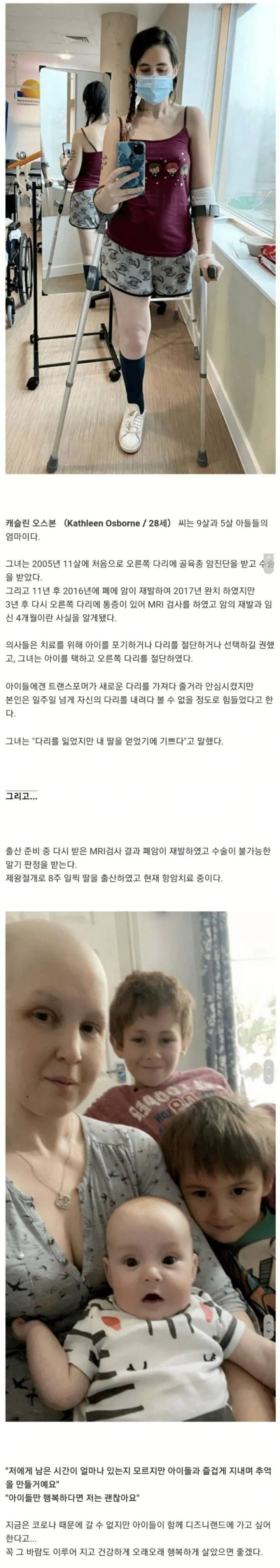 아이를 낳기위해 다리를 절단한 어머니