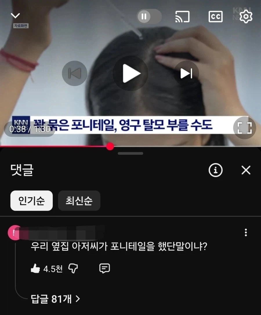 의외로 탈모를 유발하는 습관