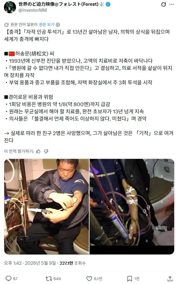 중국 민간인의 의료 기술.jpg