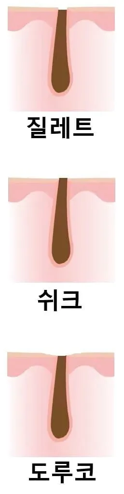 면도날 3황의 면도후 느낌
