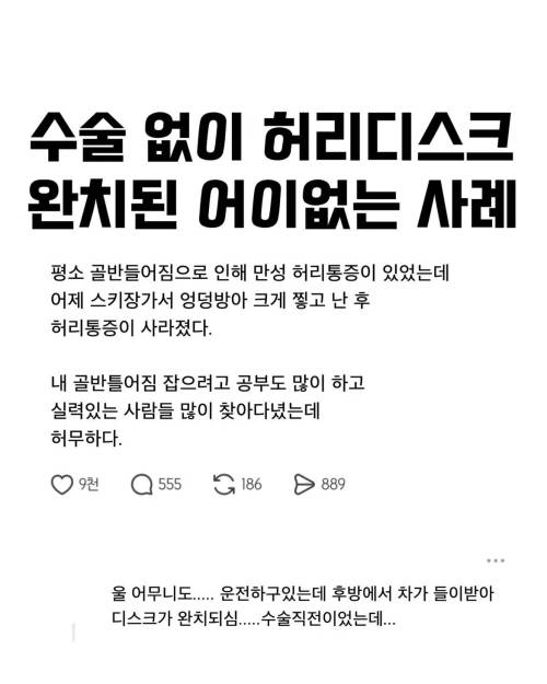 황당하게 허리디스크 완치된 사례
