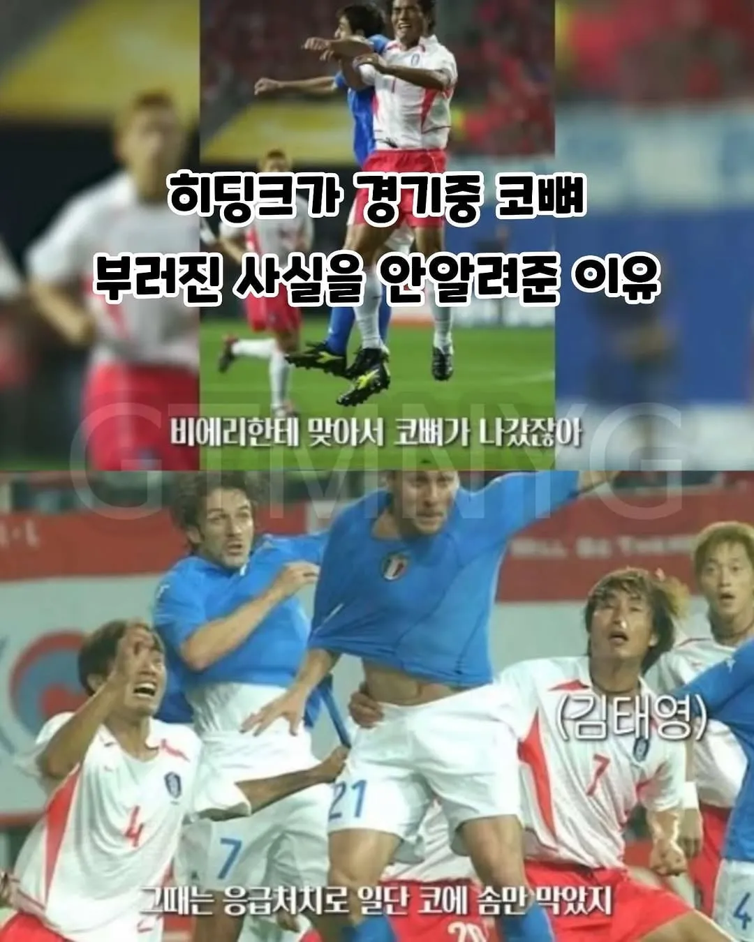 히딩크가 경기중 코뼈 부러진 사실을 안알려준 이유.jpg