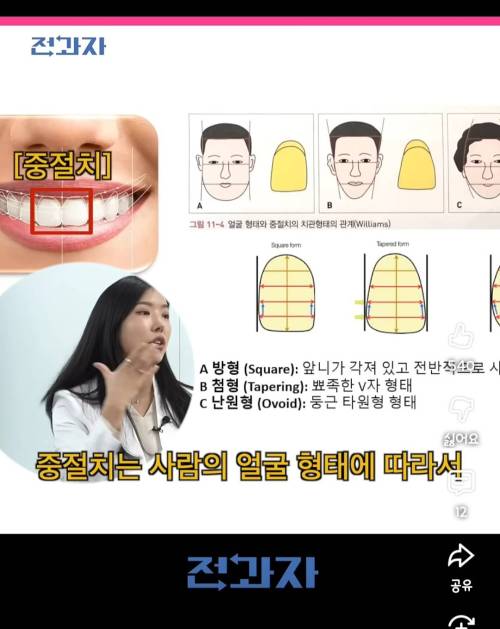 얼굴형에 따라서 앞니 모양이 다르다고 함