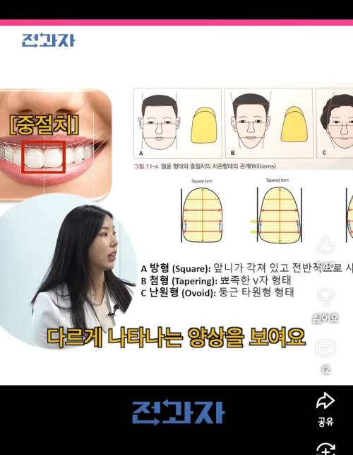 얼굴형에 따라서 앞니 모양이 다르다고 함