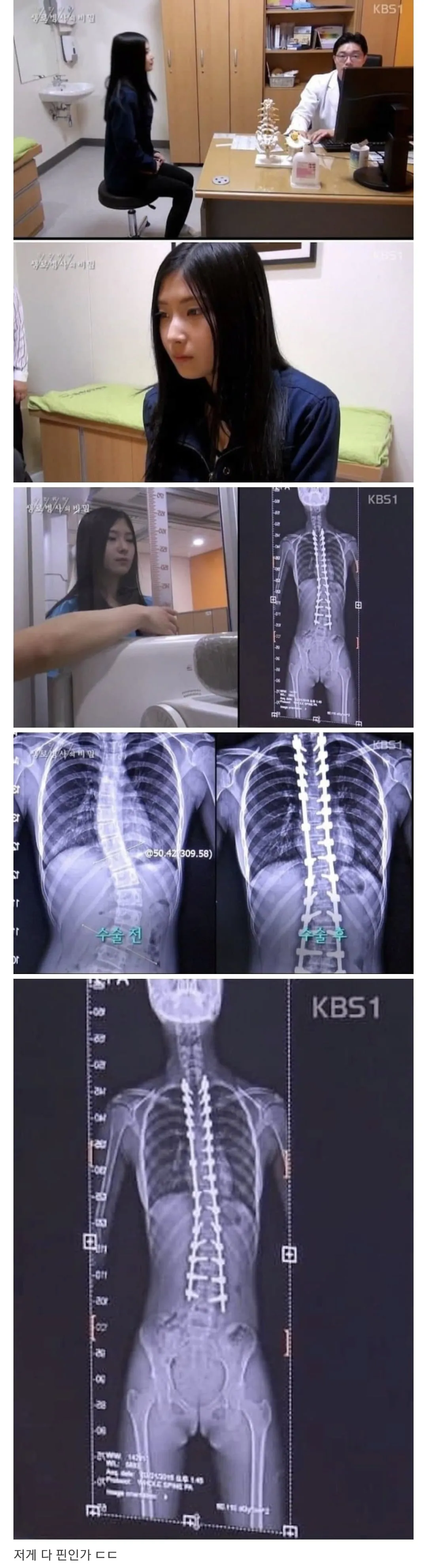 당신이 지금 허리를 펴야 하는 이유