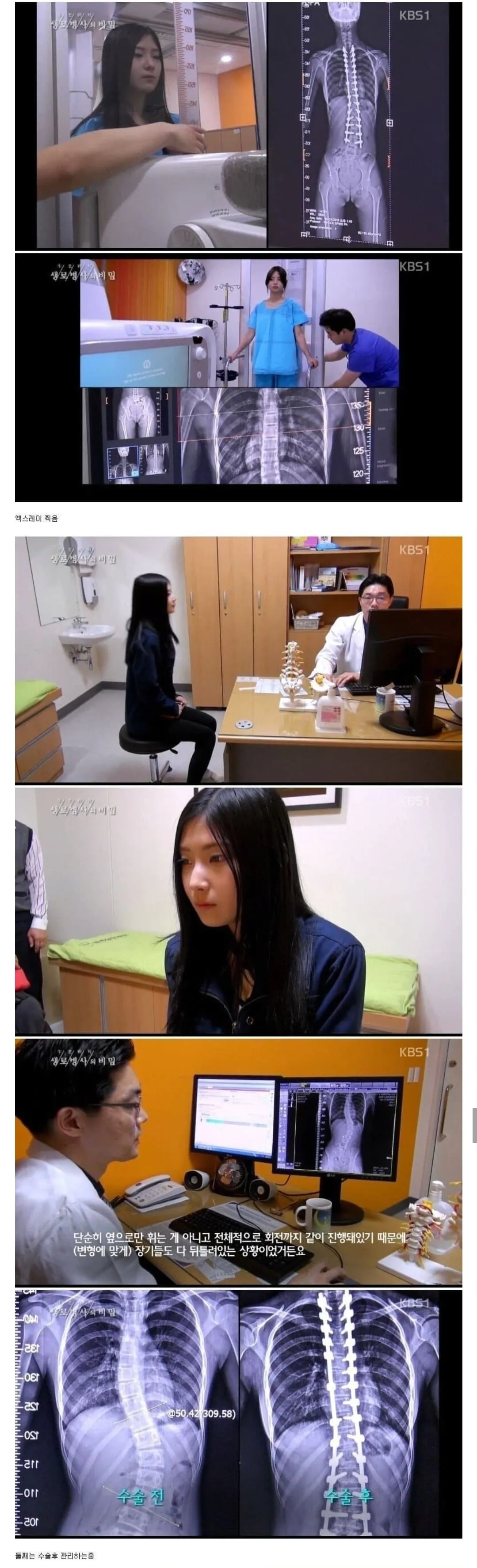 당신이 지금 허리를 펴야 하는 이유
