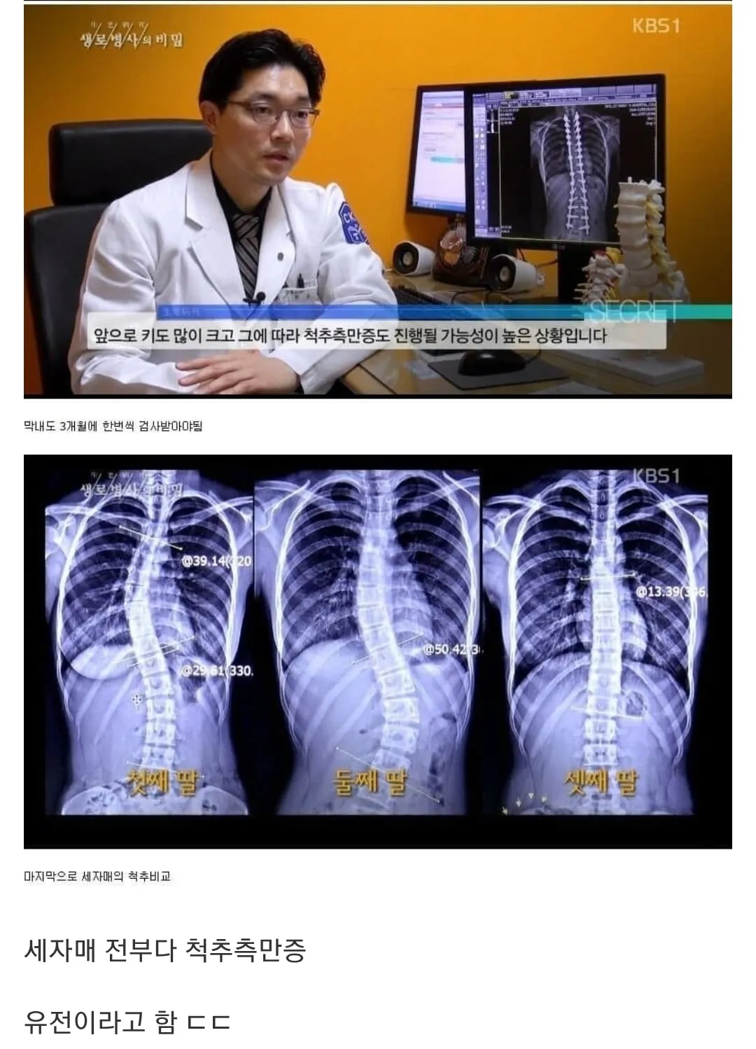 당신이 지금 허리를 펴야 하는 이유
