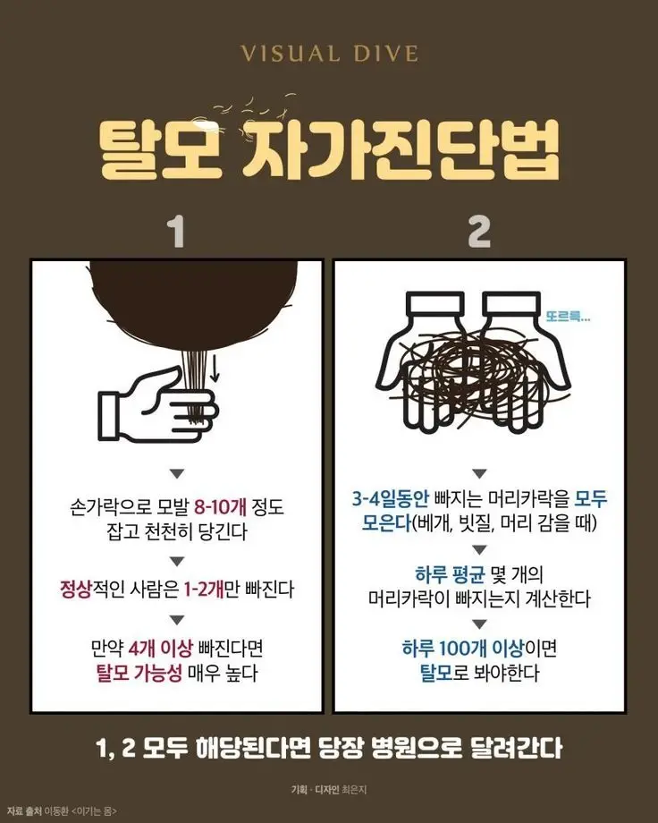 탈모 자가진단법