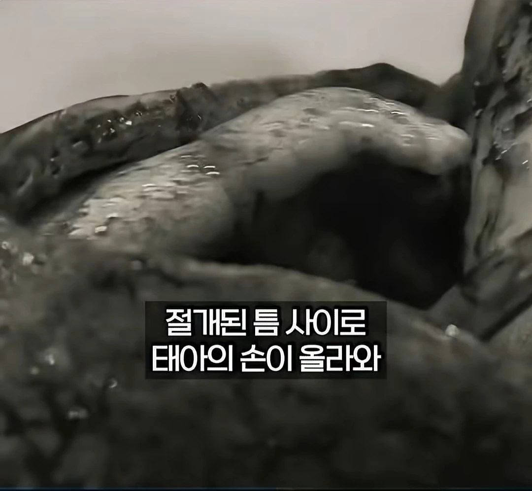 냉혈한 의사가 무너진 3초.jpg