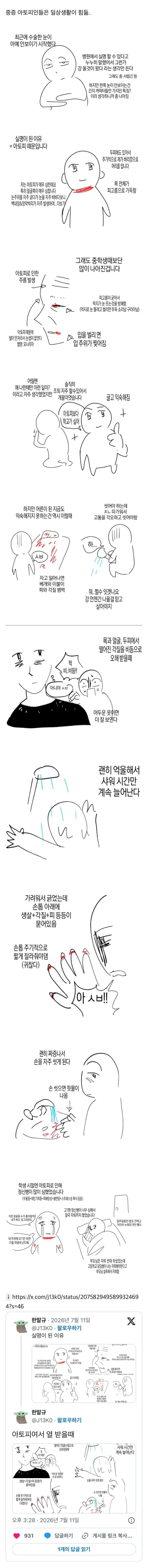 아토피가 정말 힘든 이유