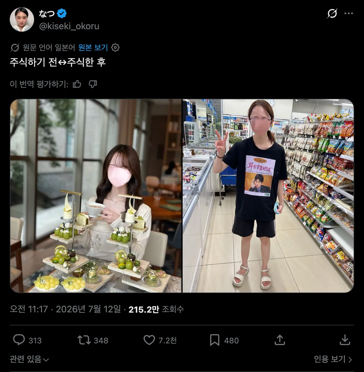 주식하기 전↔︎주식한 후