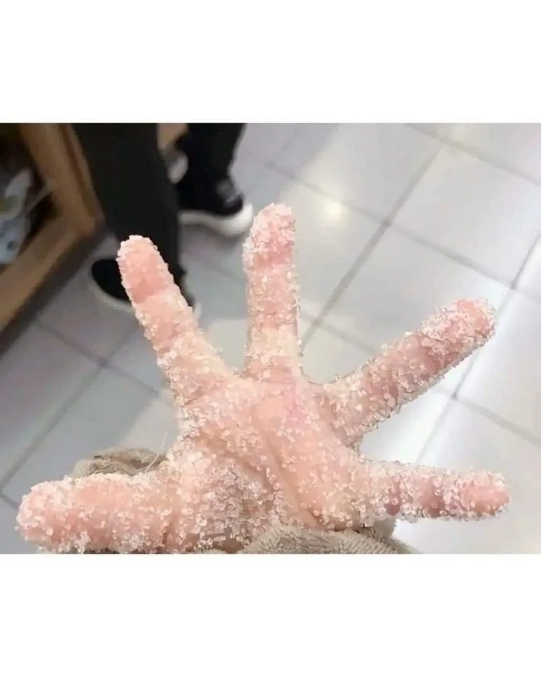 막을 수 없는 빠른 손~!