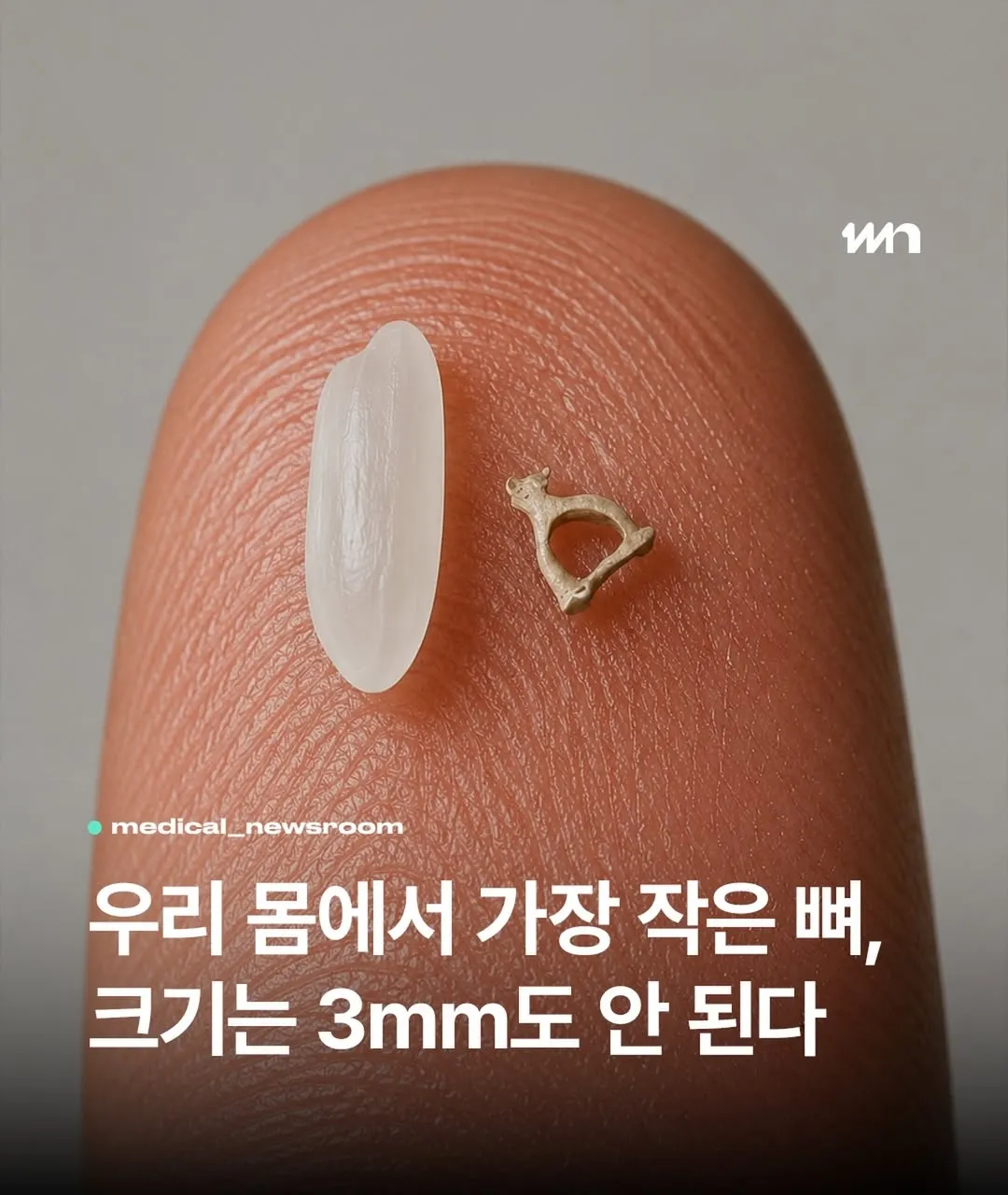 우리 몸에서 가장 작은 뼈.jpg