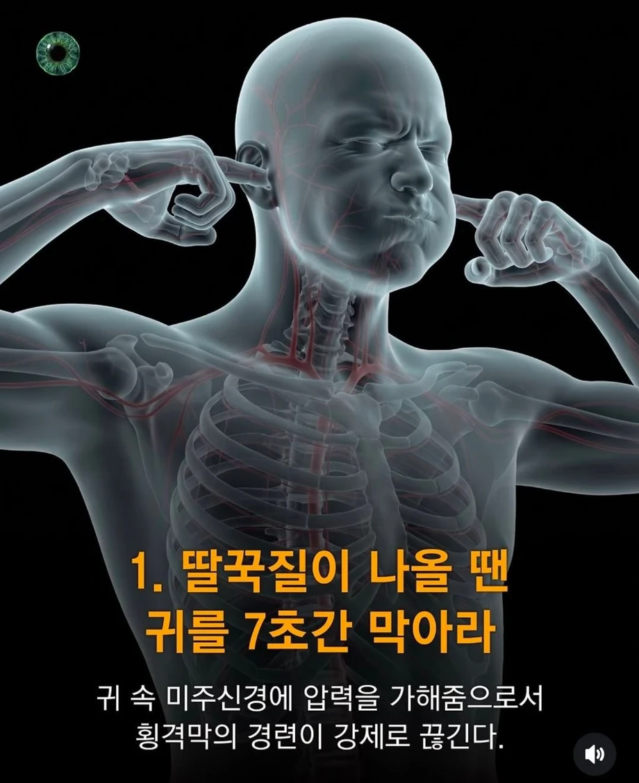 생활속 육신의 응급상황 대처법.jpg