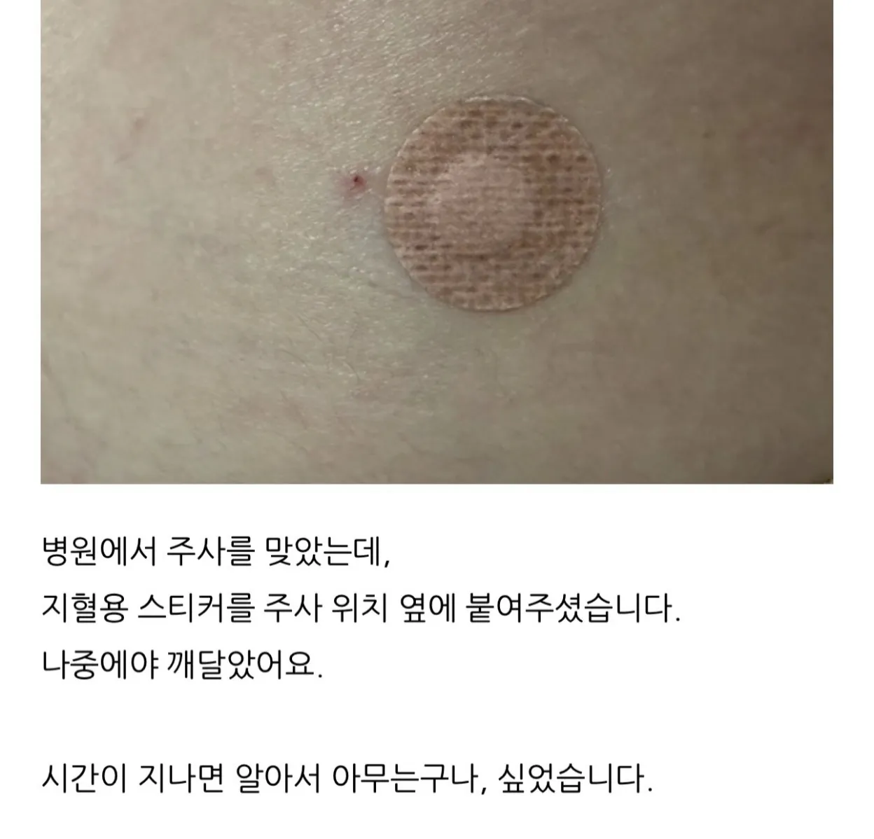 병원에서 주사를 맞았는데.jpg