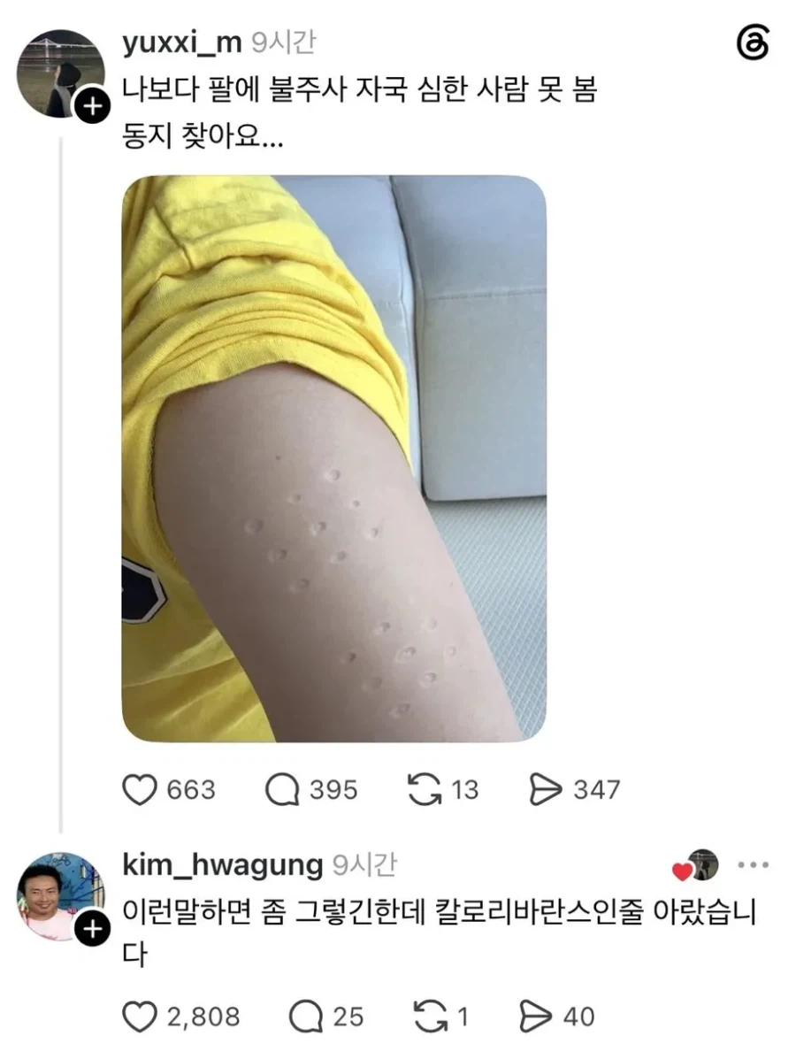 나보다 불주사 자국 심한사람 있음?