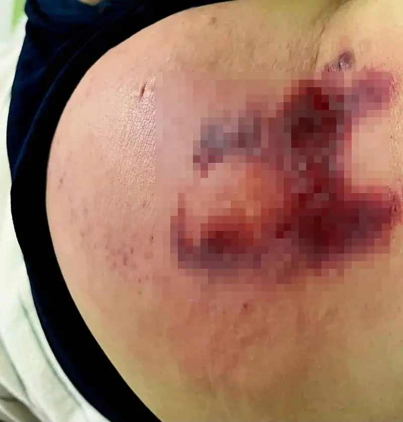 약혐) 아빠한테 엉덩이 맞아서 사과 받고 싶은 여대생.jpg