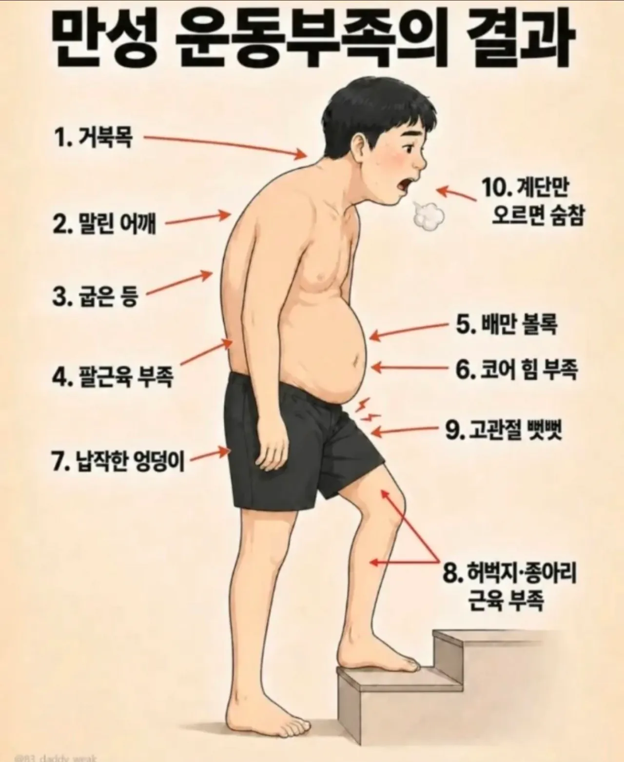 만성 운동부족 남자의 몸.jpg