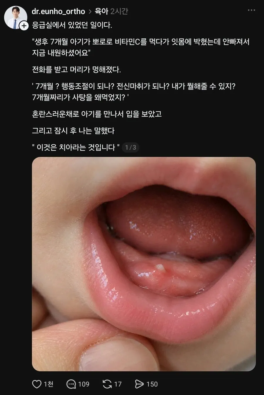 아기 잇몸에 사탕이 박혀 응급실에 감ㄷㄷㄷ.jpg