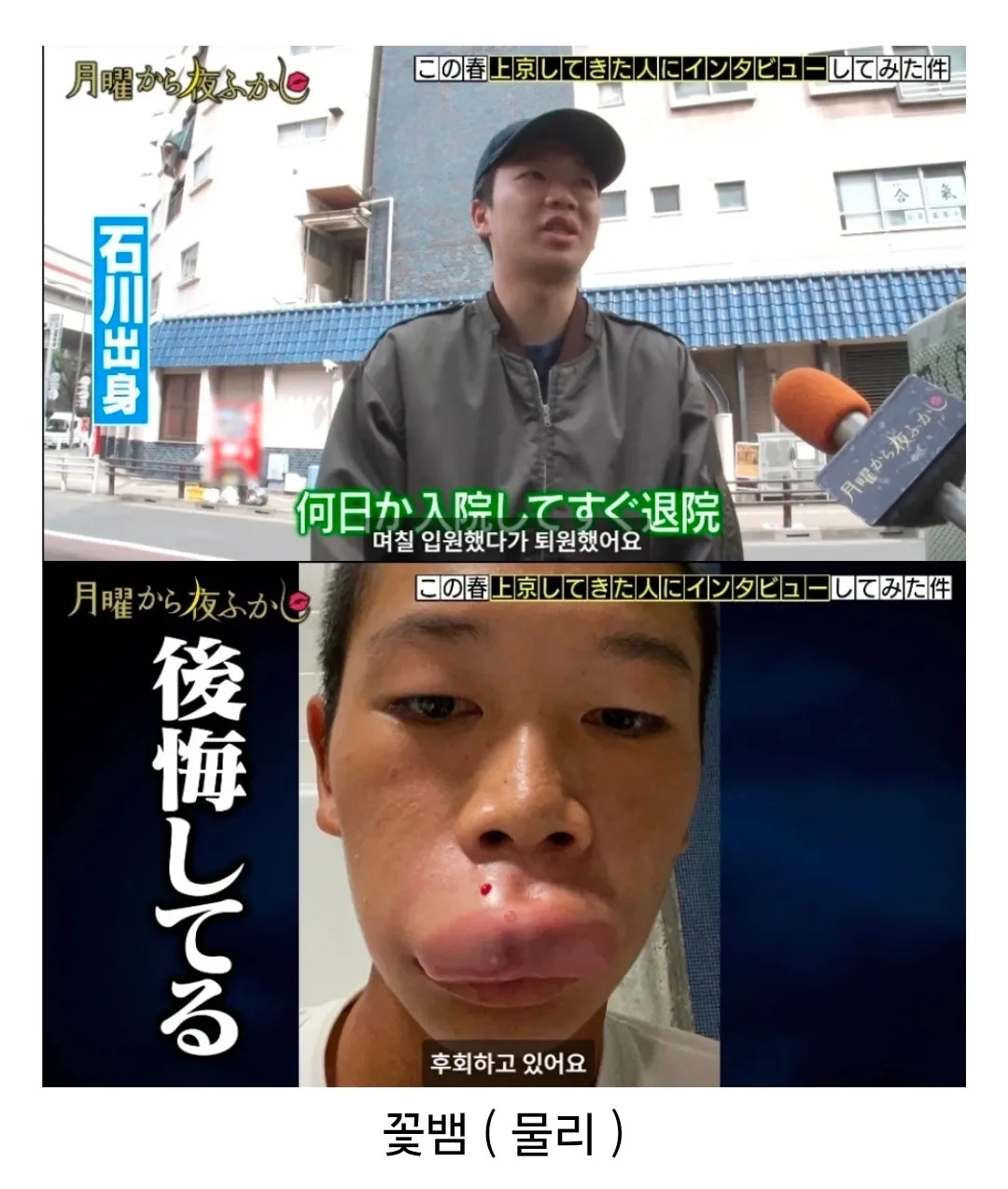 도쿄에 오자마자 꽃뱀에게 물린 시골 청년.jpg